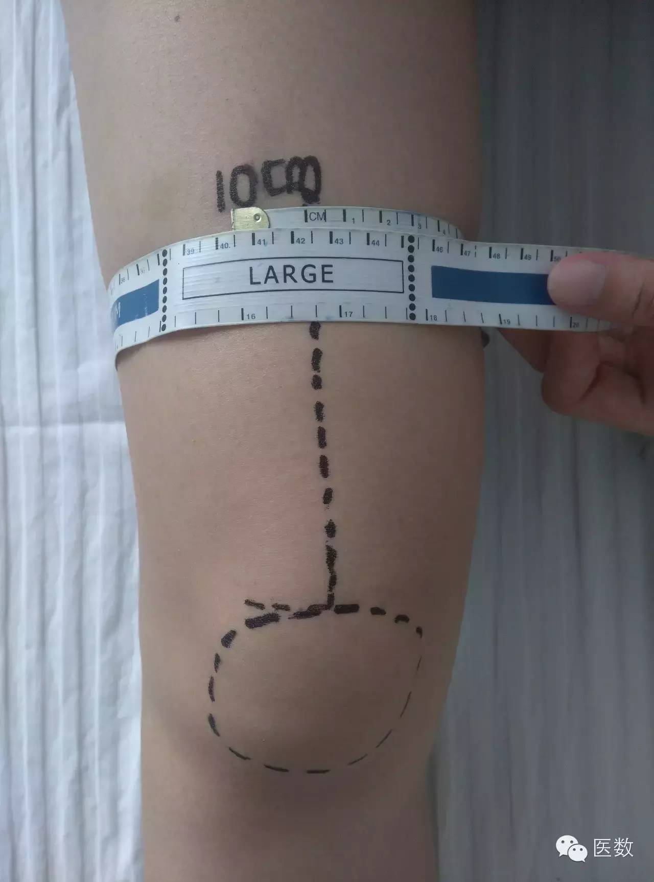 判定：如何测量膝关节周径？_医数